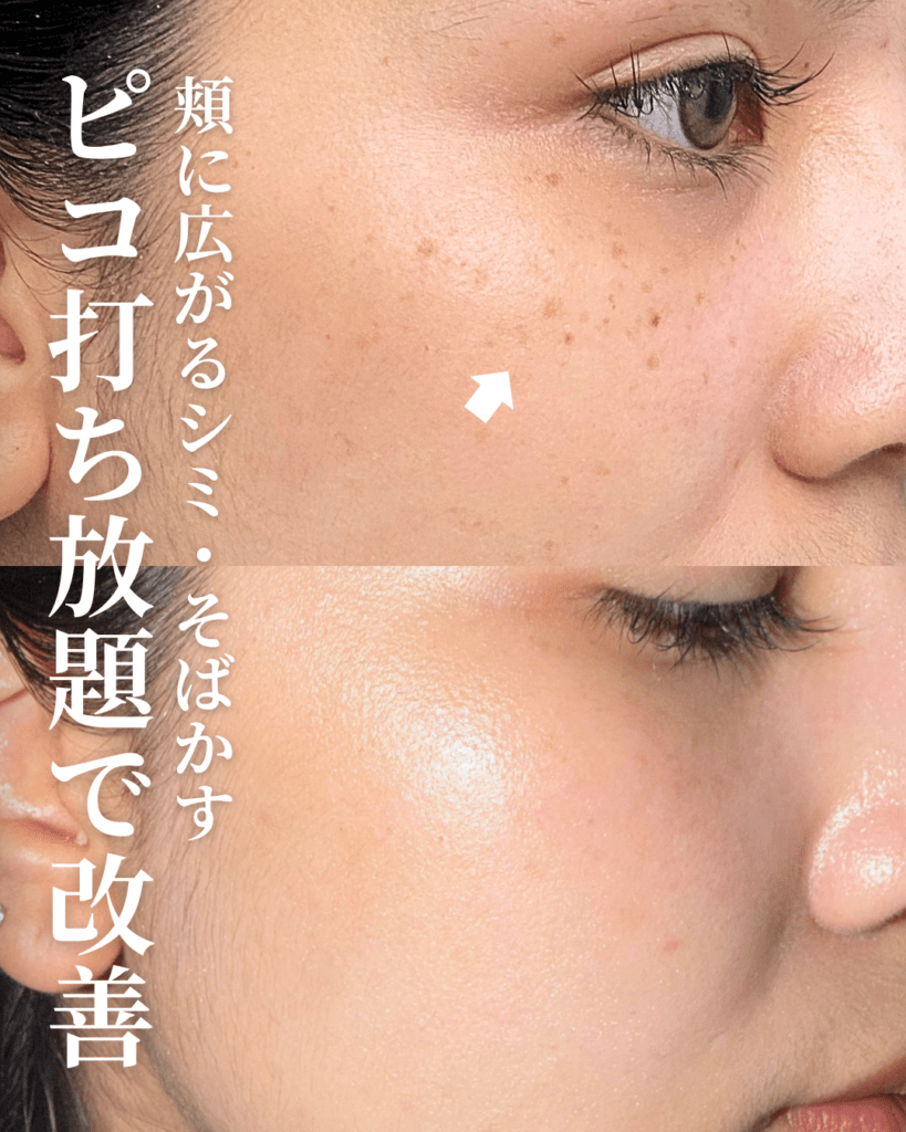 バンコクシミ取り