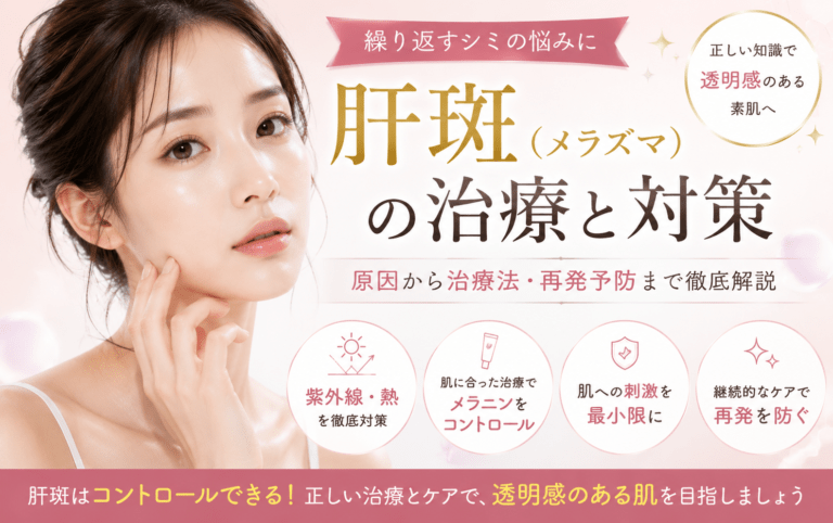 Melasma