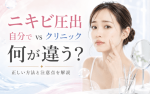 ニキビ圧出は自分でしてもいい？